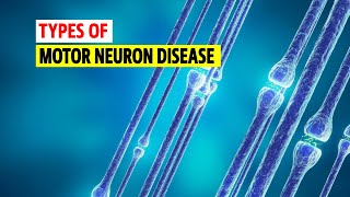 Types of Motor neuron disease [upl. by Nishom]