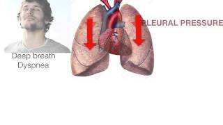 3 minutes Pitfall in IVC ultrasound [upl. by Artema]