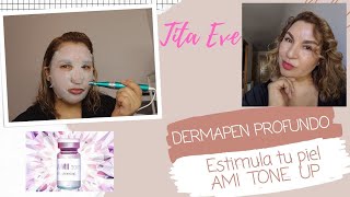 Resultados Impresionantes con DERMAPEN PROFUNDO AMI TONE UP titaeve esteticamesoterapiadermapen [upl. by Euqinwahs]