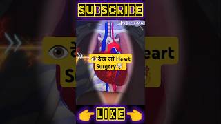 Heart Surgery Stent Video heartsurgery FruitSurgery FoodSurgery ASMR shorts [upl. by Solim]