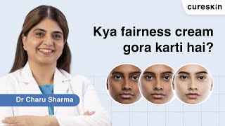 Must watch if you use fairness creams  Dr Charu Sharma  Cureskin [upl. by Neetsirhc]