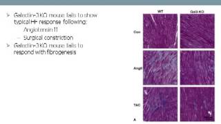 Galectin 3 Enabling a New Pharmaceutical Paradigm in Treatment f eart Failure [upl. by Hseham914]