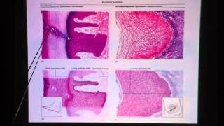 Keratinized Stratified Squamous Epithelium [upl. by Terriss996]