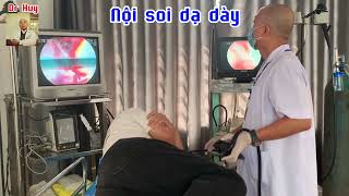 Gastroscopy for early cancer diagnosis  Nội soi dạ dày chẩn đoán ung thư sớm [upl. by Hartzell]