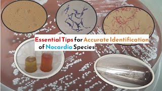 Essential Tips for Accurate Identification of Nocardia Species [upl. by Nrojb]