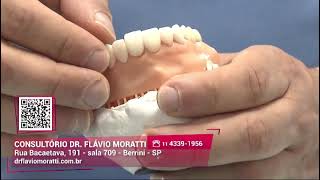 DR FLÁVIO MORATTI  PRÓTESE FACIAL  CIRURGIA ORTOGNÁTICA drflaviomoratti [upl. by Atisusej]