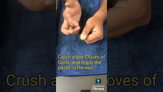 Natural Remedy for Nail Fungus Garlic IndianYogaAndNaturopathyCentre [upl. by Addiego591]