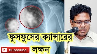 ফুসফুসের ক্যান্সারের লক্ষন। Symptoms of Lung Cancer [upl. by Nady624]