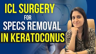 ICL Surgery For Keratoconus [upl. by Xyla]