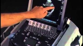 How to Echocardiography  Subcostal View [upl. by Hcir460]