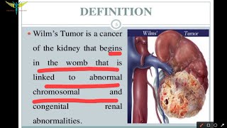 Wilms tumor or Nephroblastoma [upl. by Adnalue]