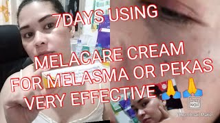 MELACARE CREAM 7DAYS USING EFFECTIVE MELACARE CREAM FOR MELASMA OR PEKAS 🙏🙏LEGIT USER [upl. by Nemaj]