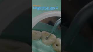 Essentials in endodontics ULTRA X eighteeth [upl. by Acim398]