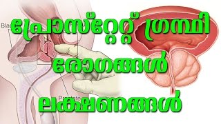 പ്രോസ്റ്റേറ്റ് ഗ്രന്ഥി രോഗങ്ങൾ ലക്ഷണങ്ങൾ Prostate diseases symptoms  Dr R Vijayan  Arogyavicharam [upl. by Moir]