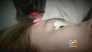 Skin Scare Laser Treatments Could Increase Risk Of Cancer [upl. by Suoivatra]