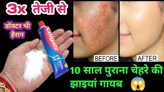 7 दिन में 10 साल पुराने झाइयां दागधब्बे निसान को जड़ सेखत्म करेंHow to Remove pigmentation [upl. by Ayotan]