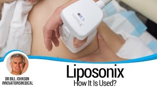 Liposonix USA Generation II Clinical Video  1st Treatment In Dallas Office [upl. by Nwahsirhc]