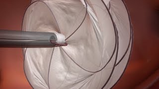 GORE® CARDIOFORM Septal Occluder PFO Animation [upl. by Dowdell615]