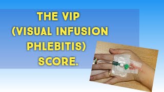 What is Phlebitis and How is it Treated [upl. by Boy67]