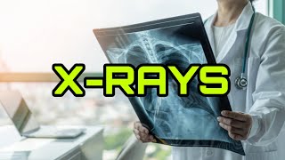 What Are XRays [upl. by Ruby899]