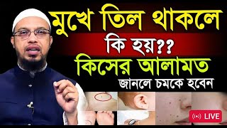 মুখে তিল থাকলে কি হয় জানেন কিসের লক্ষণশায়খ আহমাদুল্লাহSheikh Ahmadullah1122024 [upl. by Martine]