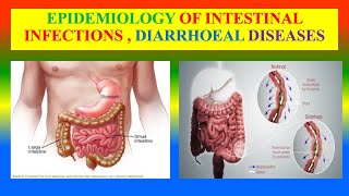 EPIDEMIOLOGY OF INTESTINAL INFECTIONS  DIARRHOEAL DISEASES [upl. by Trakas]