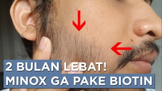 Progres Minoxidil 2 Bulan Tanpa Biotin [upl. by Atinaujnas232]