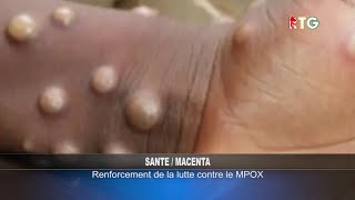 MACENTA  LA MALADIE MPOX RTG GUINEE 224 [upl. by Arakihc572]