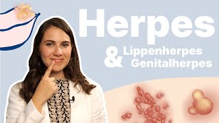 Herpes am Mund schnell weg bekommen Und Intimherpes am Mund  möglich 👄│Dr med Alice Martin [upl. by Eikcin]