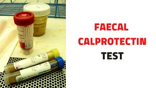 FECAL STOOL CALPROTECTIN TEST Uses Inflammatory Bowel Disease [upl. by Beitch]