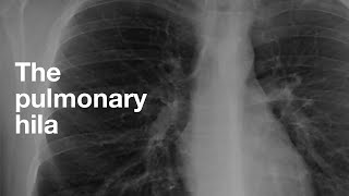 The Pulmonary Hila [upl. by Martino890]