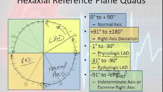 12 Lead Interpretation Part 3 Rwave Progression Electrical Vectors amp Axis Deviations [upl. by Subak]