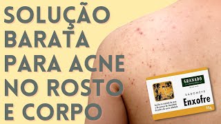 ENXOFRE Solução Final da Acne Fúngica e Corporal  Produtos para Acne que FUNCIONAM EP 04 [upl. by Sumetra]