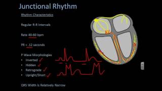 Junctional Rhythm [upl. by Llenyr]