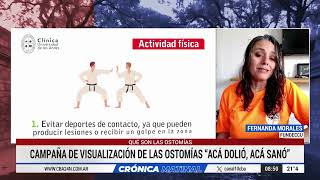 QUÉ SON LAS OSTOMÍAS CAMPAÑA DE VISUALIZACIÓN “ACÁ DOLIÓ ACÁ SANÓ” de FUNDECCU [upl. by Nanon]