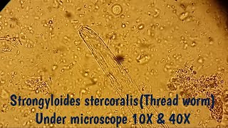 Strongyloides stercoralis under microscopeStool MicroscopyView at 10 and 40XThreadworm microscopy [upl. by Jecon526]