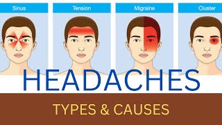 HEADACHES  types and causes [upl. by Hedley]