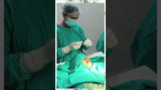 Excision of Ranula  Surgery  Ranula treatment  Dr Ranjana Butola [upl. by Drusus776]