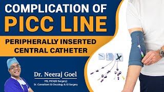 Understanding Complications and Management of Peripherally Inserted Central Catheters PICC line [upl. by Jochbed]