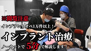 【グロイので閲覧注意】 インプラント治療の全てを5分でノーカット解説！ [upl. by Cleodell895]