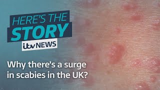 Why there’s a surge in scabies in the UK  ITV News [upl. by Eeb798]