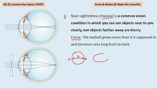 Q 925 Solution Ray Optics CBSE Std 12 Physics [upl. by Sirak799]