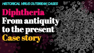 Diphtheria From antiquity to the present Case story 🦠Historical virus outbreak cases [upl. by Sibella]