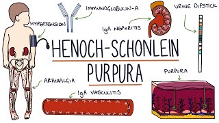 HenochSchonlein Purpura Visual Explanation for Students [upl. by Nobell]