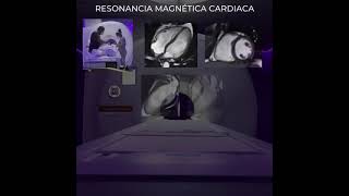 RESONANCIA MAGNETICA CARDIACA  CENTRO MEDICO DIGITAL [upl. by Eneleahs968]