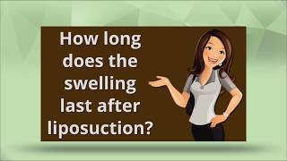 Swelling After Liposuction [upl. by Aidul]