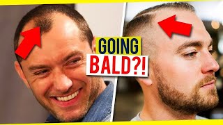 How To Tell If Your Hairline Is Receding  Signs of Balding In Men [upl. by Laresa]