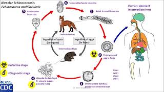 Hydatid cyst of Echinococcus granulosusDog tapeworm  Discussed in details everything you need [upl. by Audre]