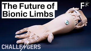 3D printed mindcontrolled prosthetics are here  Challengers by Freethink [upl. by Ytok542]