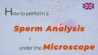 How to perform a sperm analysis under the microscope  urologist göttingen [upl. by Perkin]